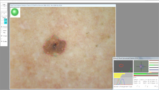 DBMips Processed